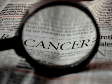 ​Decatur AL Dentist | Oral Cancer Screening Can Save Your Life 